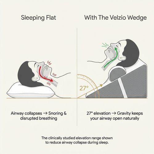 The Velzio Wedge