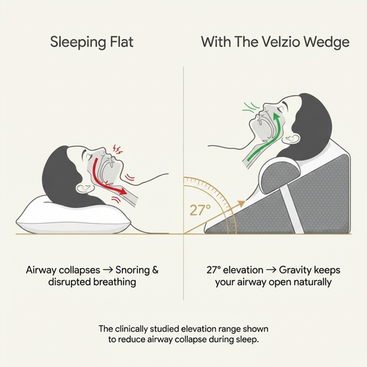 The Velzio Wedge